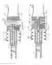 Fig. 07 - Dual reservoir coupler