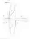 Fig. 04 - Pliable-wall air ducts with internal expanding structures