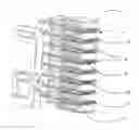 Fig. 01 - Embossed plate external oil cooler