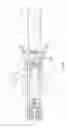 Fig. 08 - Overshot device