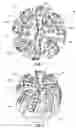 Fig. 02 - Earth-boring tools including replaceable cutting structures and related methods