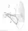 Fig. 02 - Device for scattering bulk material