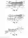 Fig. 07 - Microfluidic System And Corresponding Method For Transferring Elements Between Liquid Phases And Use Of Said System For Extracting Said Elements