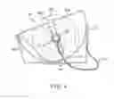 Fig. 05 - Apparatus for Dispensing Plastic Bags