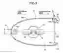 Fig. 04 - Seeding device