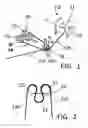 Fig. 02 - DEVICE FOR HANDLING OF ROPES AND USE THEREOF