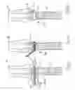 Fig. 07 - Device Support for a Stringed Instrument