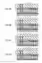 Fig. 05 - SOLID-STATE IMAGING DEVICE AND MANUFACTURING METHOD OF SOLID-STATE IMAGING DEVICE