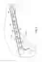 Fig. 08 - Reinforced vehicle structure