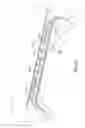 Fig. 22 - Reinforced vehicle structure
