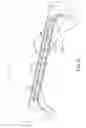Fig. 22 - Reinforced vehicle structure