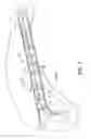 Fig. 08 - Reinforced vehicle structure