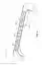Fig. 22 - Reinforced vehicle structure