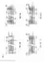 Fig. 20 - ELECTROACTIVE POLYMER TRANSDUCERS FOR TACTILE FEEDBACK DEVICES