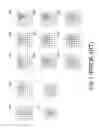 Fig. 02 - Method and apparatus for detecting displacement with sub-pixel accuracy