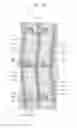 Fig. 04 - DISPLAY SUBSTRATE, DISPLAY PANEL AND DISPLAY DEVICE