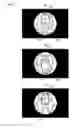 Fig. 07 - Wide view vehicle periphery image generation apparatus
