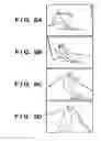Fig. 06 - Magnifying playback/display