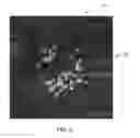 Fig. 06 - 3D retinal disruptions detection using optical coherence tomography