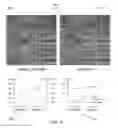 Fig. 07 - 3D retinal disruptions detection using optical coherence tomography