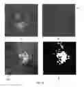 Fig. 09 - 3D retinal disruptions detection using optical coherence tomography