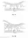 Fig. 11 - Method and apparatus for determining a deviation of an actual shape from a desired shape of an optical surface