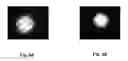 Fig. 09 - Intra-cavity frequency doubled microchip laser operating in TEMtransverse mode