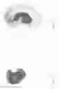 Fig. 06 - Earpiece system