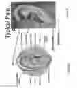 Fig. 07 - Earpiece system