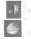 Fig. 10 - Earpiece system
