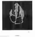 Fig. 10 - Simulation of medical imaging