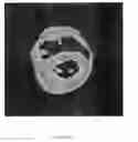 Fig. 12 - Simulation of medical imaging