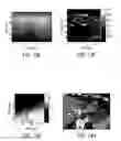 Fig. 20 - Method and system for processing ultrasound data