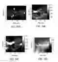 Fig. 22 - Method and system for processing ultrasound data