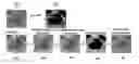 Fig. 01 - Method of segmenting lesions in images