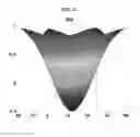 Fig. 06 - Method of segmenting lesions in images