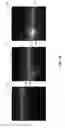 Fig. 06 - Methods and systems of optical imaging for target detection in a scattering medium