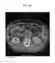 Fig. 09 - METHOD AND SYSTEM UTILIZING ITERATIVE RECONSTRUCTION WITH ADAPTIVE PARAMETERS FOR COMPUTER TOMOGRAPHY (CT) IMAGES