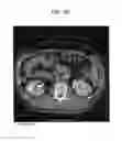 Fig. 10 - METHOD AND SYSTEM UTILIZING ITERATIVE RECONSTRUCTION WITH ADAPTIVE PARAMETERS FOR COMPUTER TOMOGRAPHY (CT) IMAGES