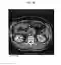 Fig. 13 - METHOD AND SYSTEM UTILIZING ITERATIVE RECONSTRUCTION WITH ADAPTIVE PARAMETERS FOR COMPUTER TOMOGRAPHY (CT) IMAGES
