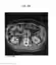 Fig. 15 - METHOD AND SYSTEM UTILIZING ITERATIVE RECONSTRUCTION WITH ADAPTIVE PARAMETERS FOR COMPUTER TOMOGRAPHY (CT) IMAGES