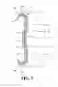 Fig. 06 - Combination of bracket and slide assembly