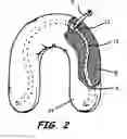 Fig. 03 - Method and device for automatic buoyancy compensation for a scuba diver or underwater device while in any orientation