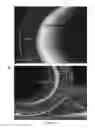 Fig. 07 - Ionic liquid mediated sol-gel sorbents