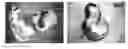 Fig. 01 - Method of diagnosing the presence of a tumor in a mammal by assessing CDO expression levels