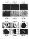 Fig. 08 - Method of diagnosing the presence of a tumor in a mammal by assessing CDO expression levels