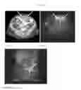 Fig. 11 - FOLATE-TARGETED DIAGNOSTICS AND TREATMENT