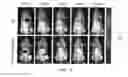 Fig. 02 - Selective infarcted-tissue-targeting bacteria and use thereof