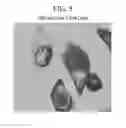 Fig. 09 - Fluorescent phospholipid ether compounds, compositions, and methods of use