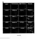 Fig. 04 - Gingiva Derived Stem Cell And Its Application In Immunodulation And Reconstruction